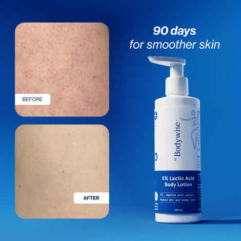 Buy Be Bodywise 5% Lactic Acid Body Lotion - 200 ml - Purplle