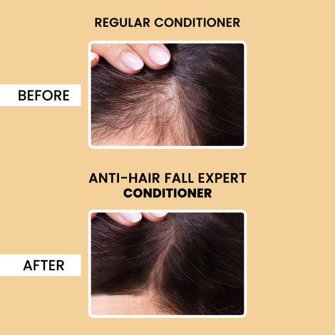 Alps Goodness Fenugreek Biotin and Redensyl Anti Hairfall Hair Conditioner 200 ml Methi Hairloss Control Conditioner For All Hair Types
