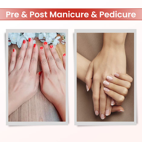 Buy peticare top
