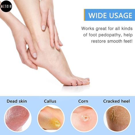 MeSkin Foot File Callus Remover Pedicure Foot Scrubber with