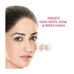 Buy Fair & Lovely Anti Marks Treatment Face Cream (18 g) - Purplle