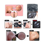 Buy Charcoal Nose Mask Deep Cleansing Blackhead Remover Pore Refining (10 Pouches) - Purplle