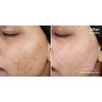 Buy Pond’s Flawless Radiance Derma+ SPF 30 PA+++ Moisturizing Day Cream (50 g) - Purplle