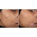 Buy Pond’s Flawless Radiance Derma+ SPF 15 PA+++ Mattifying Day Cream (50 g) - Purplle