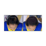 Buy Hair4Real Hair Fiber Refill Pack Dark Brown (12 g + 25 g) - Purplle