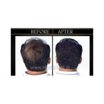 Buy Hair4Real Hair Fiber Refill Pack Dark Brown (12 g + 25 g) - Purplle