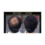 Buy Hair4Real Hair Fiber Refill Pack Black (12 g + 25 g) - Purplle