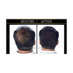 Buy Hair4Real Hair Fiber Refill Pack Black (12 g + 25 g) - Purplle