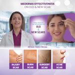 Buy Mederma Advanced Plus Gel (10 g) - Purplle