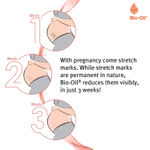 Buy Bio Oil - (25 Ml) (Specialist Skin Care Oil - Scars, Stretch Mark, Ageing, Uneven Skin Tone - Purplle