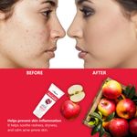 Buy LA Organo Apple Cider Vinegar Face Wash (100 g) - Purplle
