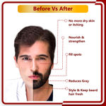 Buy Newish Beard Growth Oil for Men (50 ml) - Purplle