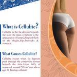 Buy Zenvista Meditech Anti Cellulite slimming oil, Shape Up, Fat Reduction, Weight loss (100 ml) - Purplle