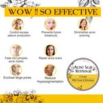 Buy Zenvista Meditech Scars Removal, Acne Scars/ Dark Spot , All types of scars with Almond Oil,Rosemary, Vitamin B3, Grapeseed & other natural ingredients (50 gm) - Purplle