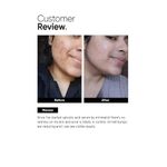 Buy Minimalist 2% Salicylic Acid Face Serum For Acne, Blackheads & Open Pores, 30 ml - Purplle