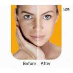 Buy Love Earth Anti-Blemish & Anti-Pigmentation Cream With Aloe Vera & Vitmain E For Reducing Acne, Pimples, & Skin Brightening 50gm - Purplle