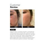 Buy Minimalist 3% Tranexamic Face Serum for Melasma, Post Inflammatory Hyperpigmentation(PIH) or Erythema(PIE) & Acne Scars, 30 ml - Purplle