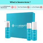 Buy SkinKraft Severe Acne kit For Oily Skin - Customized Acne Kit - 3 Product Kit- Oily Skin Cleanser + Oily Skin Moisturizer + Severe Acne Active Serum - Dermatologist Approved - Purplle