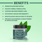 Buy BIOAYURVEDA Anti-White Spots Healing Cream 120 gm - Purplle