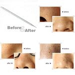 Buy Beautiliss Black Head Remover - Pointed - Purplle