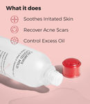 Buy COSRX AC Collection Calming Liquid Mild (125 ml) - Purplle