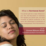 Buy Carmesi Acne Spot Correction and Blemish Reduction Combo - Purplle