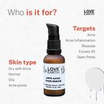 Buy Love Earth Anti Acne Serum With Pure Vitamin C & Witch Hazel For Acne Free And Even Skin Tone Suitable For All Skin Types 30ml - Purplle