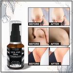 Buy LUXURI Neck, Knee & Elbow Whitening Serum with Vitamin- C, Glutathione & Alpha Arbutin / Intimate Area Whitening All Skin Types-30ml - Purplle