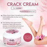 Buy Globus Naturals Crack Cream For Dry Cracked Heels & Feet | Enriched With Aloevera | Rose|Almonds |Lavender 100 Gm - Purplle