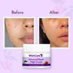 Buy WishCare Advanced Repair Night Cream - For Anti Aging & Firm Skin - Purplle