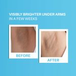 Buy DermDoc by Purplle 5% Glycolic Acid Under Arm Treatment (100 ml) | darkened underarms, lightening spray | body odour, dark elbow, dark neck, spray, glycolic acid - Purplle