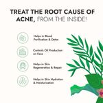 Buy Kapiva Acne Ease Juice 1L - Ayurvedic Juice for Acne Control | 4 Ayurvedic Herbs for Skincare - 1 L - Purplle