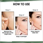 Buy UrbanYog Acne Pimple Patch For Face Treats Pimple Overnight - 72 Dots - Purplle