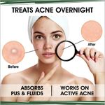 Buy UrbanYog Acne Pimple Patch For Face Treats Pimple Overnight - 72 Dots - Purplle