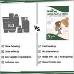 Buy UrbanYog Acne Pimple Patch For Face Treats Pimple Overnight - 72 Dots - Purplle