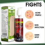Buy Urban Yog Ayurvedic jadibuti Kalonji Oil/Black Seed Onion Oil for Hair, Face & Skin Care | - Purplle