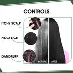 Buy Urban Yog Ayurvedic jadibuti Kalonji Oil/Black Seed Onion Oil for Hair, Face & Skin Care | - Purplle
