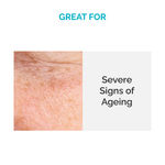 Buy SkinKraft Customized Firming Facial Serum For All Skin Types For Severe Signs Of Ageing (30 ml) - Purplle