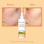 Buy WishCare Pure Glow Face Toner for Pore Tightening & Even Toned Skin with 7% AHA, Oranges & Green Tea (200 ml) - Purplle