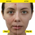 Buy Chemist at Play Sebum & Blackhead Control Face Serum with Ceramides | 2% Salicylic Acid + 1% Zinc PCA | For acne-prone & bumpy skin, controls excess sebum & improves skin texture | 30ml - Purplle