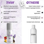 Buy TNW - The Natural Wash Stretch Mark Oil forA Reduces Stretch Marks,Relive Itching & Irritation| With Lavender & Chamomile Oil - Purplle