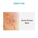 Buy SkinKraft Acne Exfoliating Face Serum For Acne & Scarring With 9% Azelaic Acid, 4% Niacinamide & Tea Tree - Face Serum For All Skin Types (30 ml) - Purplle