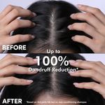 Buy Naturali Dandruff Defence Shampoo with Tea Tree Oil & Cactus Extracts | Prevents Dandruff | Paraben and Sulphate Free Shampoo | Anti Dandruff Shampoo 180 ml - Purplle