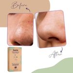 Buy Sanfe Deep Purifying Nose Strips for Women - Pack of 3 with Fuji Green Tea & Witch Hazel extracts | Removes Whiteheads | Blackheads and cleanses pores | Use on Wet Nose - Purplle