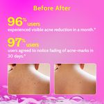 Buy Chemist at Play|1% Salicylic Acid Body Wash | For back acne (Bacne), Gently Exfoliates and Cleanses Maintains Protective Skin barrier | 473 ml - Purplle