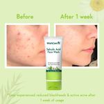 Buy WishCare 2% Salicylic Acid with AHA, GreenTea, & TeaTree For Oliy Skin & Acne- Face Wash - 100 ml - Purplle