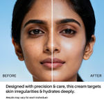 Buy DERMDOC by Purplle 0.5% Vitamin E Day Cream (50 gm) | moisturizer for dry skin | moisturizing cream - Purplle