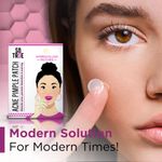 Buy Sotrue Acne Pimple Patch 36 Hydrocolloid Waterproof Patches - Purplle