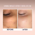 Buy Aravi Organic Vitamin E Oil For Face - Best Oil For Face, Body and Nail - Enriched Veg Vitamin E Source - For Nourish Your Face and Repair Damaged Skin - 30 ml - Purplle