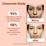 Buy Aravi Organic 20% Vitamin C Serum for Skin Brightening | Targets Dark Spots & Uneven Skin Tone | Radiance Boosting & Hydrating | For Glowing & Healthy Skin | Suitable for All Skin Types – 30 ml - Purplle
